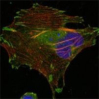 LPP Antibody in Immunocytochemistry (ICC/IF)