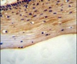 LRRC18 Antibody in Immunohistochemistry (IHC)