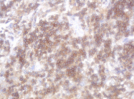 LRCH4 Antibody in Immunohistochemistry (Paraffin) (IHC (P))