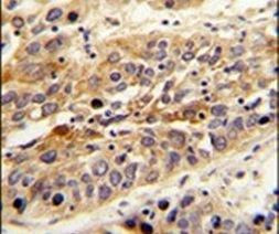 LRG1 Antibody in Immunohistochemistry (IHC)