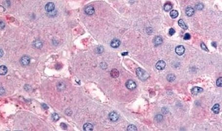 NR5A2 Antibody in Immunohistochemistry (Paraffin) (IHC (P))