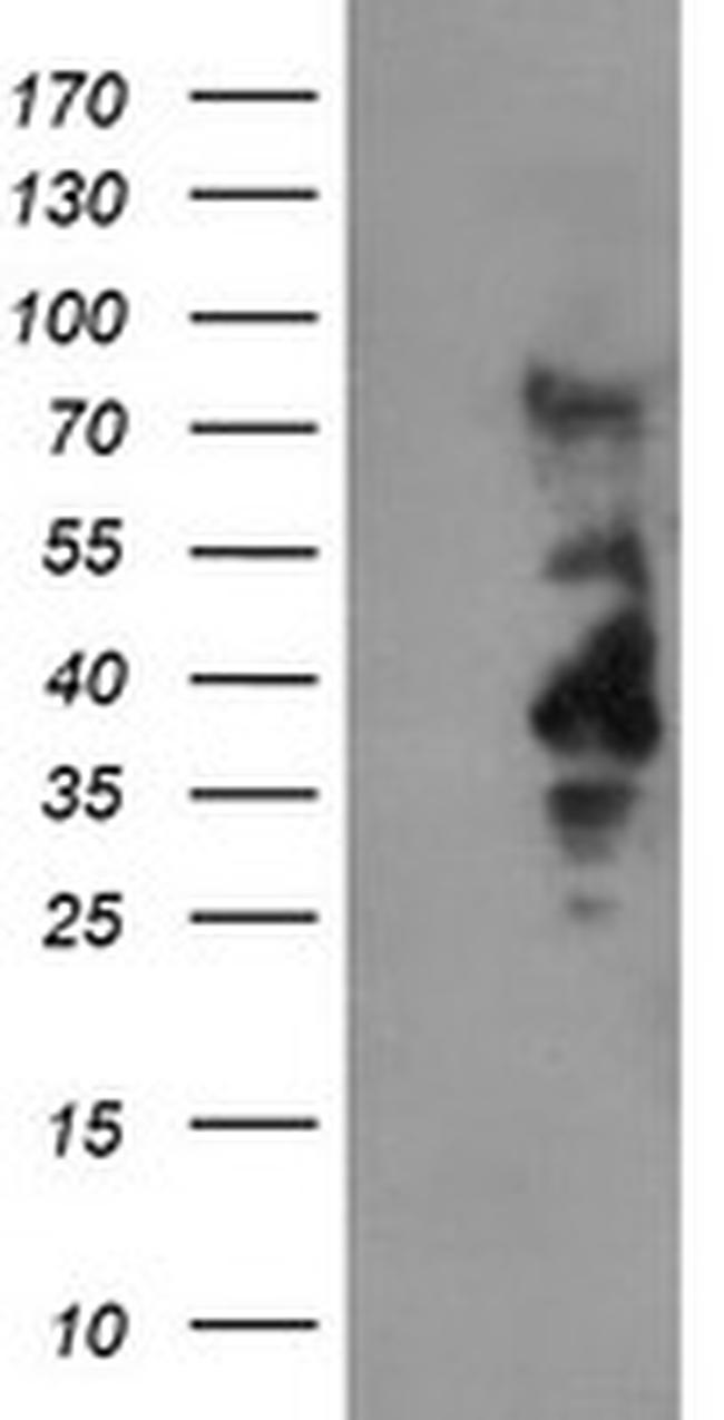 LRRC25 Antibody in Western Blot (WB)