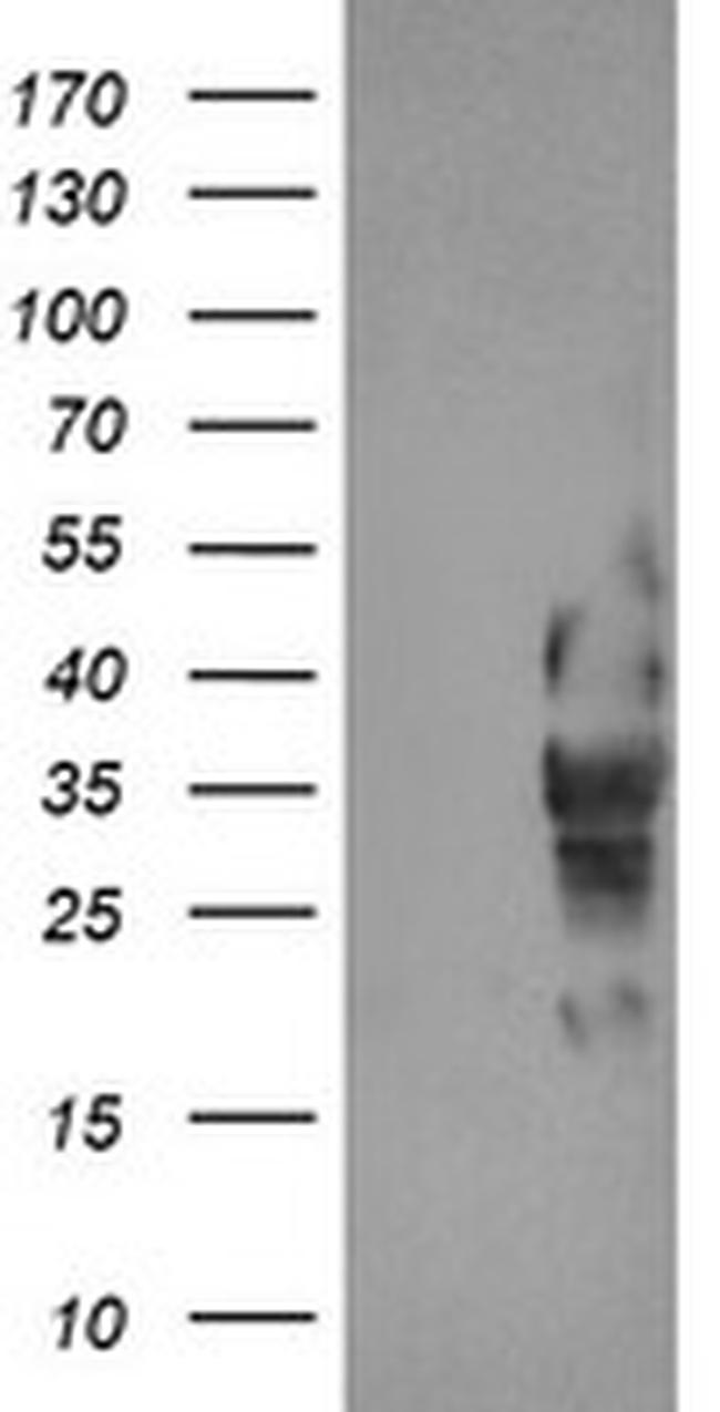 LRRC25 Antibody in Western Blot (WB)