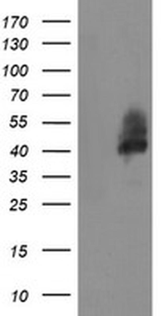 LRRC25 Antibody in Western Blot (WB)