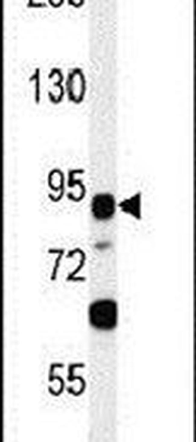 LRRC36 Antibody in Western Blot (WB)