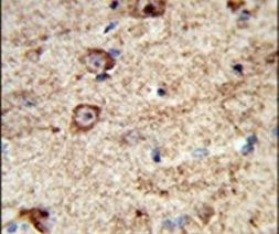 LRRC4 Antibody in Immunohistochemistry (IHC)