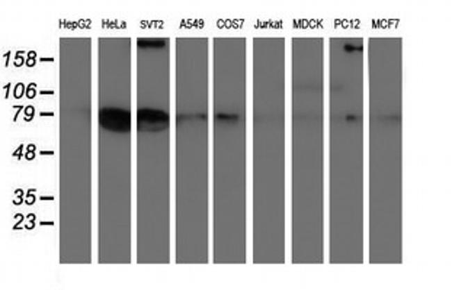 LRRC50 Antibody in Western Blot (WB)