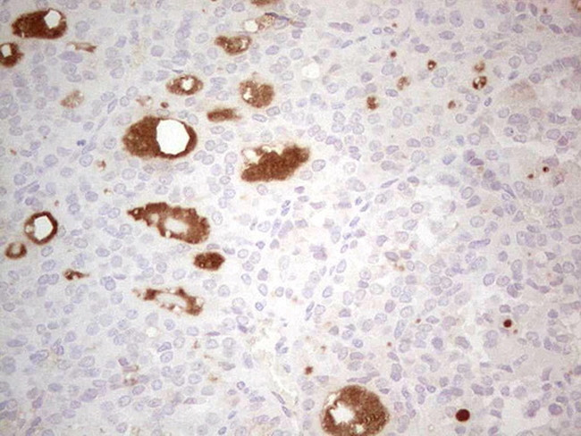 LRRC6 Antibody in Immunohistochemistry (Paraffin) (IHC (P))