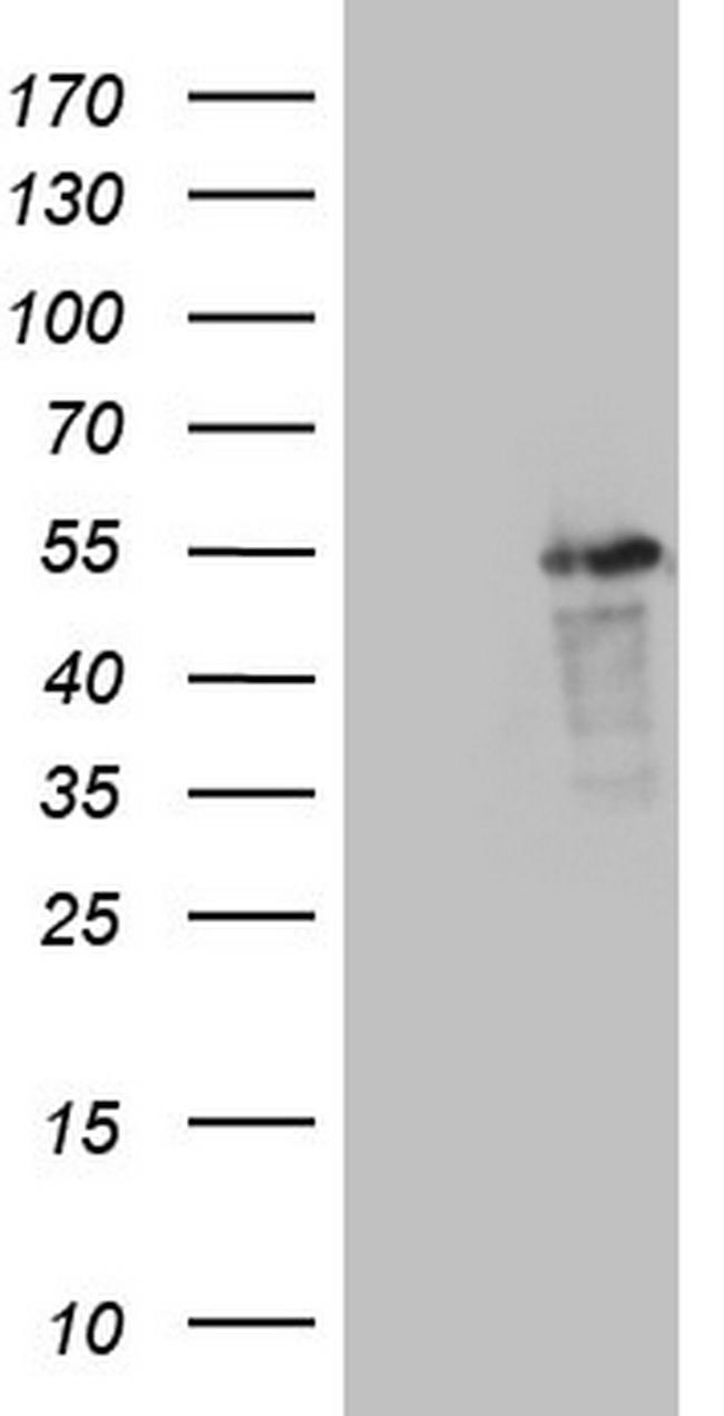 LRRC6 Antibody in Western Blot (WB)