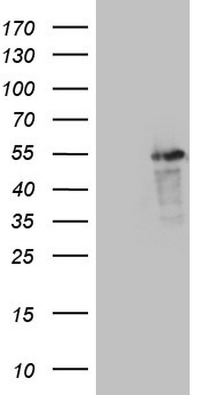 LRRC6 Antibody in Western Blot (WB)