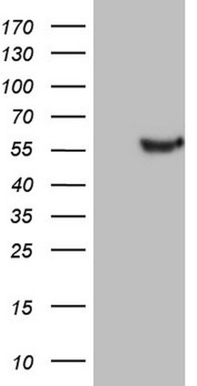 LRRC6 Antibody in Western Blot (WB)