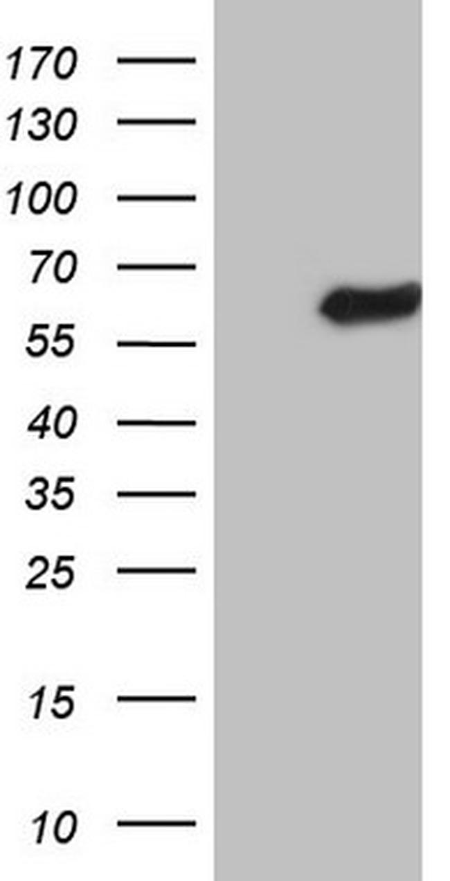 LRRC6 Antibody in Western Blot (WB)