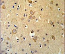 LRRTM1 Antibody in Immunohistochemistry (IHC)
