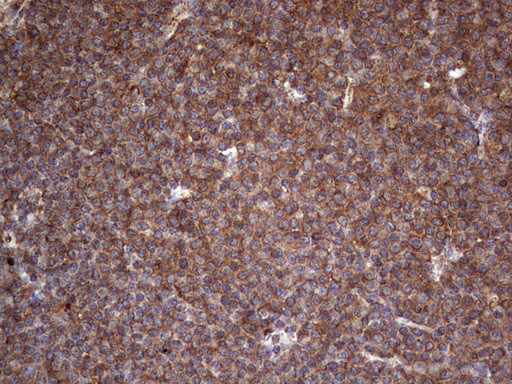 LRRTM1 Antibody in Immunohistochemistry (Paraffin) (IHC (P))