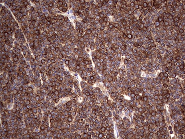 LRRTM1 Antibody in Immunohistochemistry (Paraffin) (IHC (P))