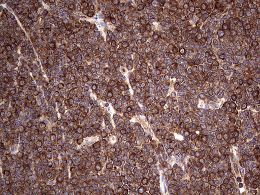 LRRTM1 Antibody in Immunohistochemistry (Paraffin) (IHC (P))