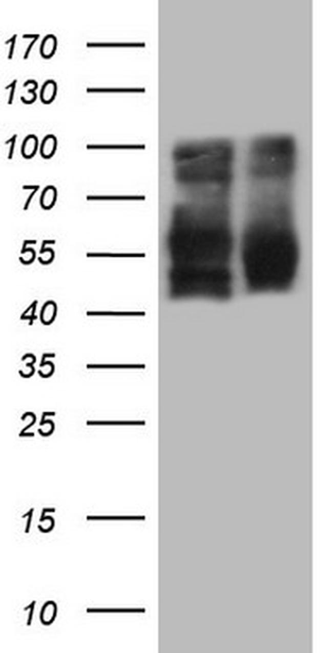 LRRTM1 Antibody in Western Blot (WB)