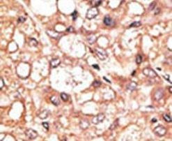 LSD1 Antibody in Immunohistochemistry (IHC)