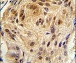 LSM1 Antibody in Immunohistochemistry (IHC)