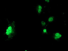 LSM1 Antibody in Immunocytochemistry (ICC/IF)