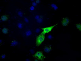 LTA4H Antibody in Immunocytochemistry (ICC/IF)