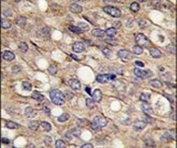 LTBP1 Antibody in Immunohistochemistry (IHC)