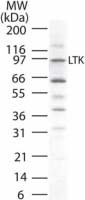 LTK Antibody in Western Blot (WB)