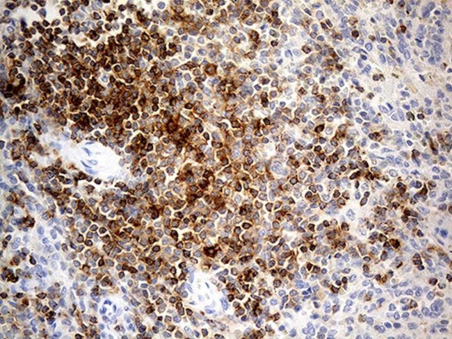 LY9 Antibody in Immunohistochemistry (Paraffin) (IHC (P))