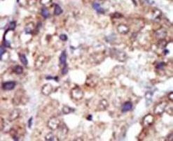 Lyn Antibody in Immunohistochemistry (IHC)