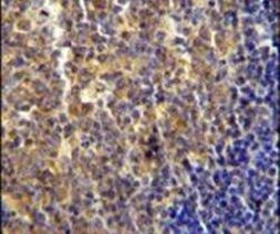 LYRM4 Antibody in Immunohistochemistry (IHC)