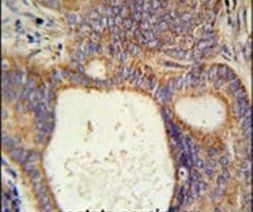 LYSMD1 Antibody in Immunohistochemistry (IHC)