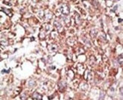LYVE1 Antibody in Immunohistochemistry (IHC)