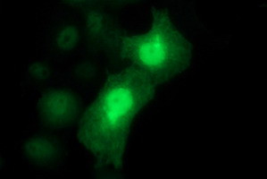 LYZ Antibody in Immunocytochemistry (ICC/IF)