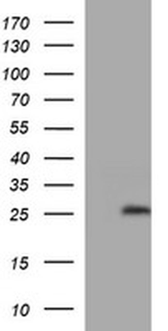 LZIC Antibody in Western Blot (WB)