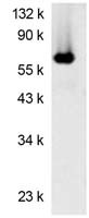 Firefly luciferase Antibody in Western Blot (WB)