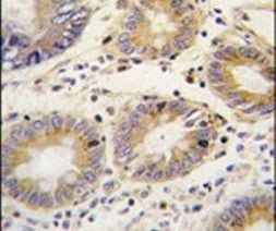 LEFTY Antibody in Immunohistochemistry (IHC)