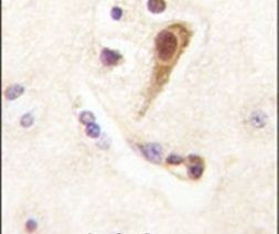 LHX6 Antibody in Immunohistochemistry (IHC)