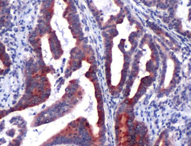 NGAL Antibody in Immunohistochemistry (IHC)