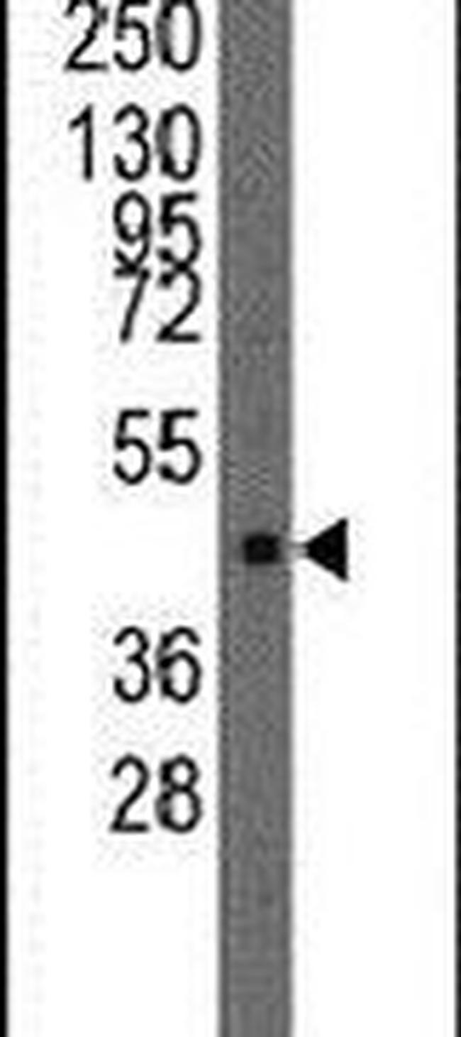 LMX1A Antibody in Western Blot (WB)