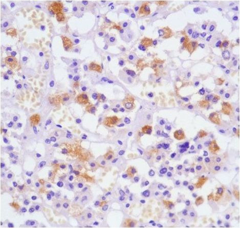 Luteinizing Hormone Antibody in Immunohistochemistry (Paraffin) (IHC (P))