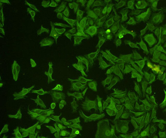 Cytokeratin 18 Antibody in Immunocytochemistry (ICC/IF)