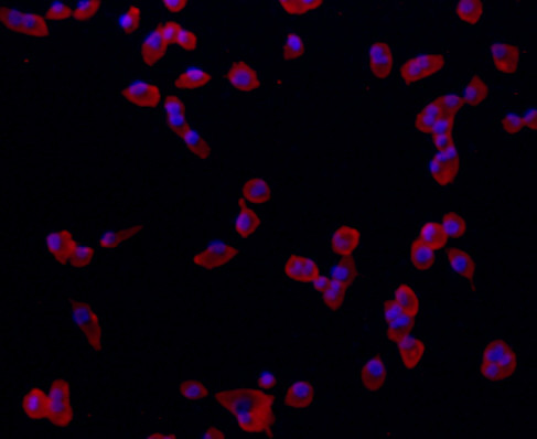 Synaptophysin Antibody in Immunocytochemistry (ICC/IF)