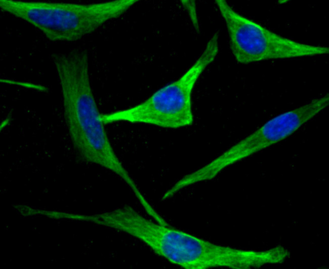 Beta III Tubulin Antibody in Immunocytochemistry (ICC/IF)