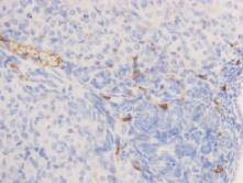 Alkaline Phosphatase Antibody in Immunohistochemistry (Paraffin) (IHC (P))
