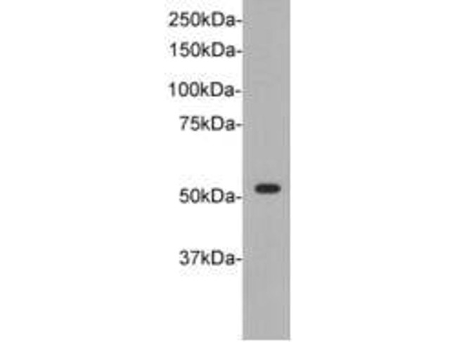 TdT Antibody in Western Blot (WB)