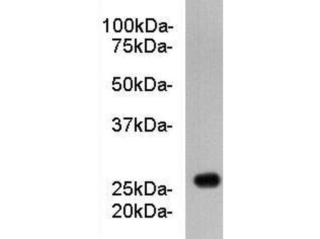 Apolipoprotein A1 Antibody in Western Blot (WB)
