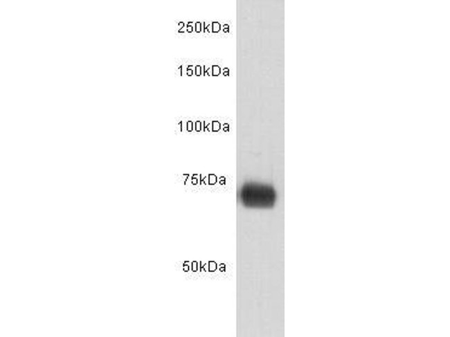 Human Serum Albumin Antibody in Western Blot (WB)