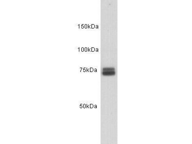Transferrin Antibody in Western Blot (WB)