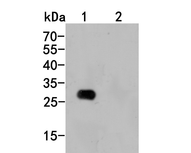 6X His tag Antibody in Western Blot (WB)