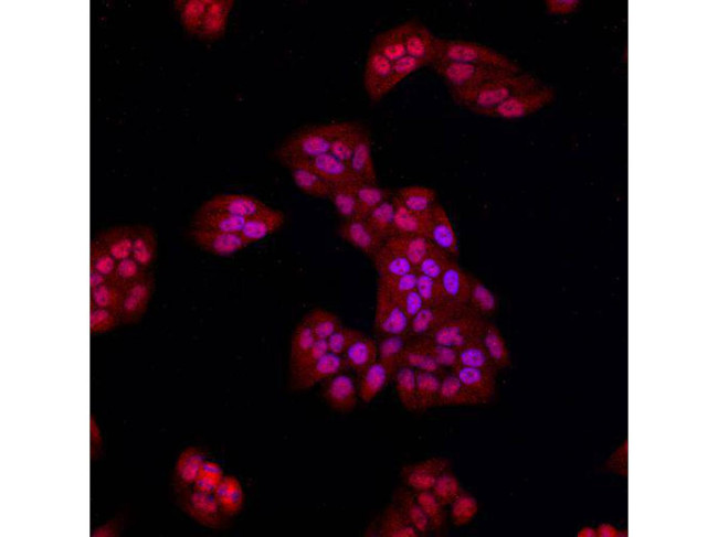 Beta-catenin Antibody in Immunocytochemistry (ICC/IF)